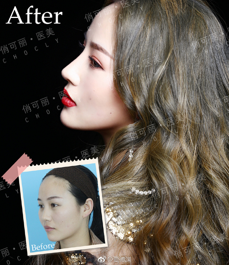 �ɶ�������¡��ҽ�������ռֵ�Ԩ��ô��