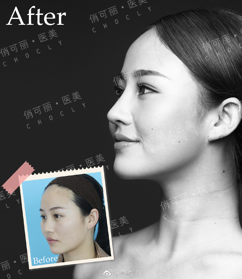 �ɶ�������¡��ҽ�������ռֵ�Ԩ��ô��