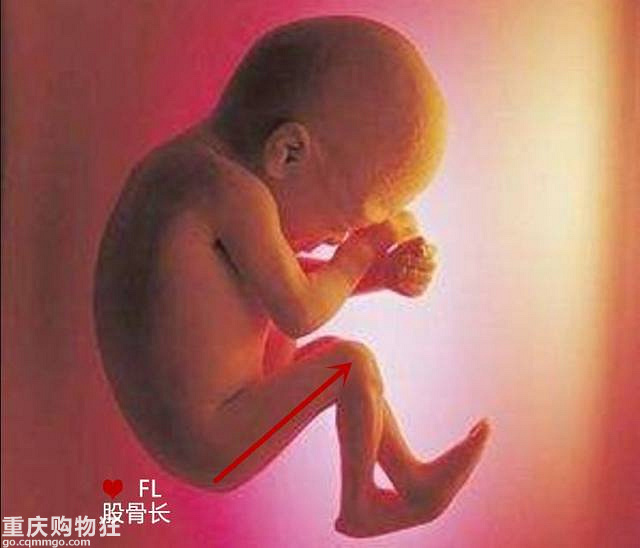 一fz学会三种算胎儿体重的方法，详解产检B超单