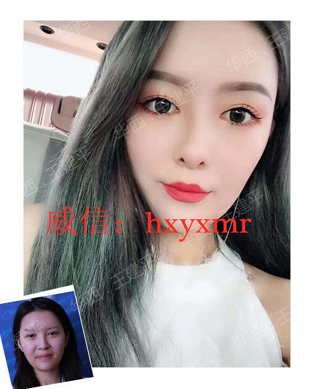 �ɶ����ۺϣ�ȫ�߹Ǳ��ۺϺͰ��߹Ǳ��ۺ�����ʲô