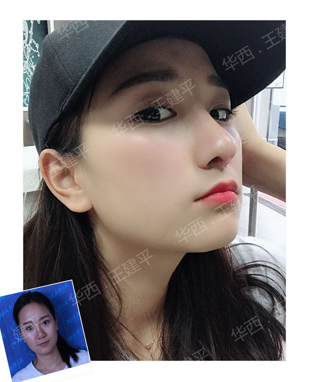 �ɶ����ۺϣ�ȫ�߹Ǳ��ۺϺͰ��߹Ǳ��ۺ�����ʲô