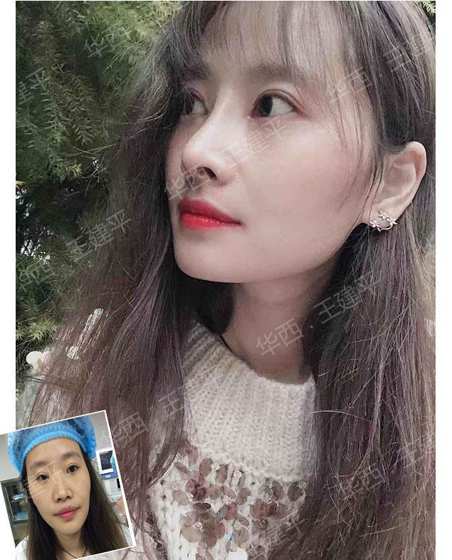 �ɶ����ۺϣ�ȫ�߹Ǳ��ۺϺͰ��߹Ǳ��ۺ�����ʲô