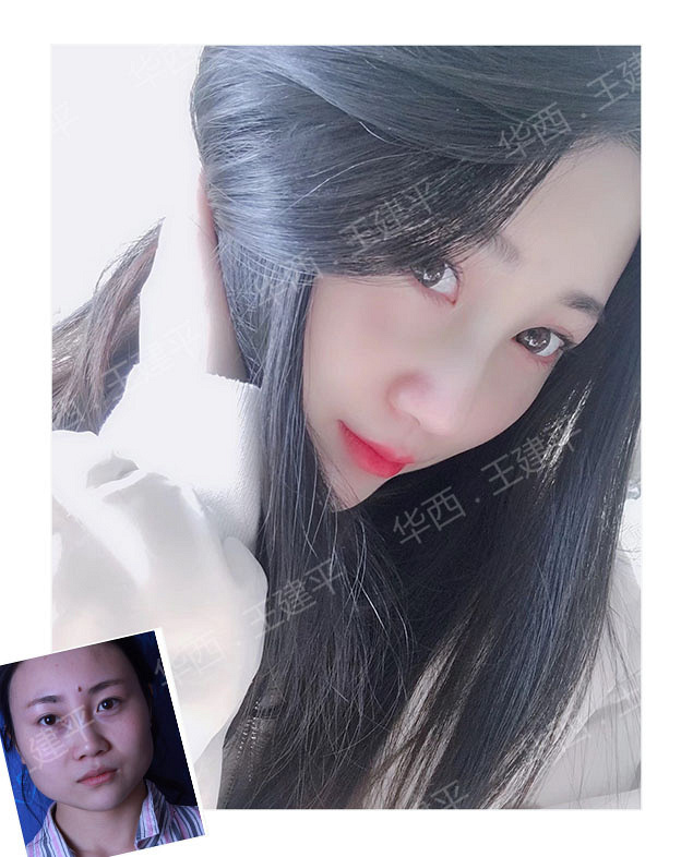 �ɶ����ۺϣ�ȫ�߹Ǳ��ۺϺͰ��߹Ǳ��ۺ�����ʲô