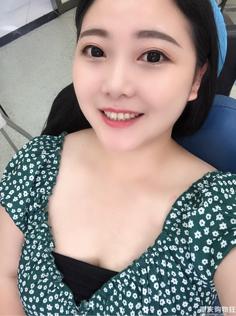 洗牙后牙齿变得超干净，当天晚上还能吃串串！