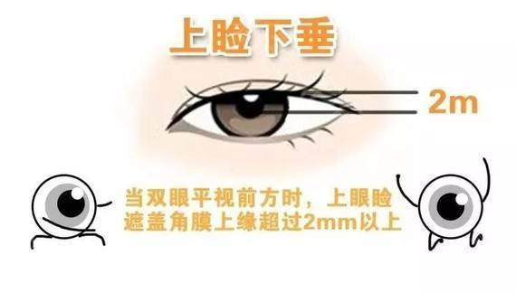 请问下,遵义割双眼皮去哪家医院好?