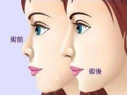 ¡ҽԺ|¡ʧܵĳ֢״Щ
