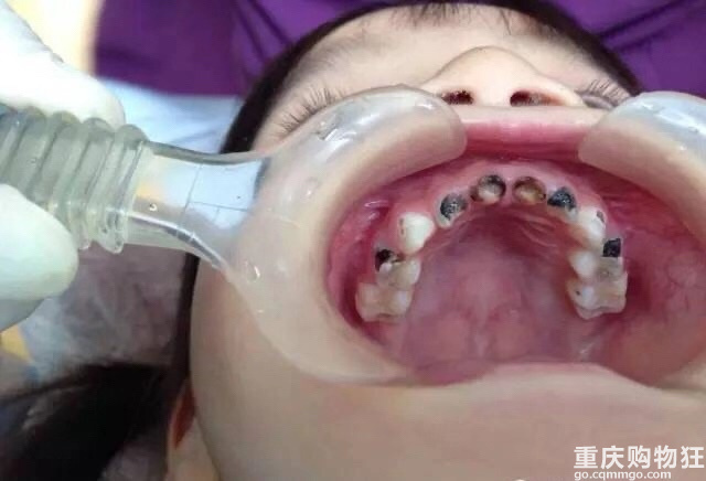 有没得好的儿童口腔推荐？