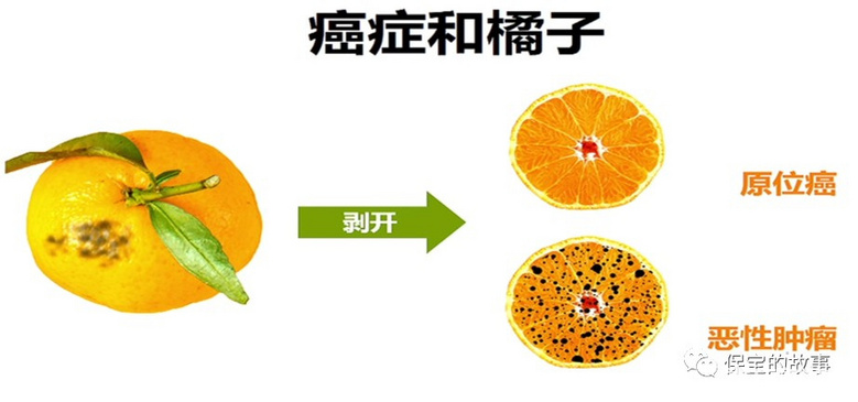 重大疾病之最低敌人-恶性肿瘤