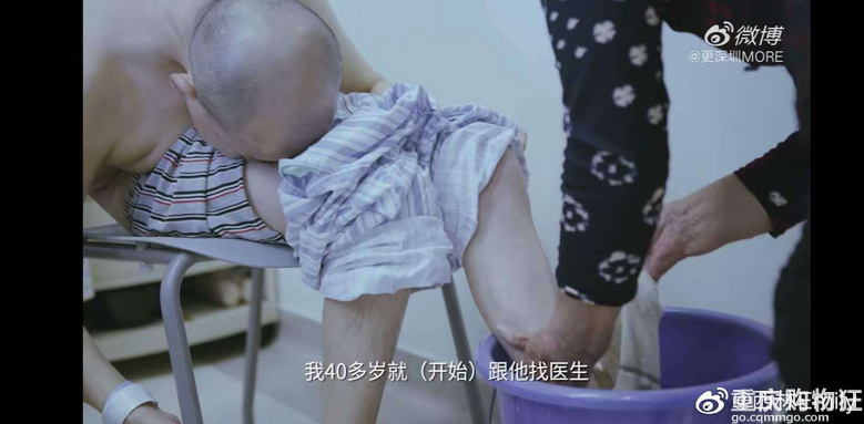 身体被敲断4次的折叠人出院，他花了20几年只为了成正常人