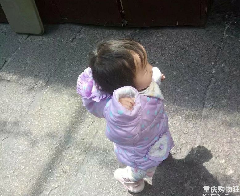 小儿髋关节脱位冶疗历程+【护理日记】
