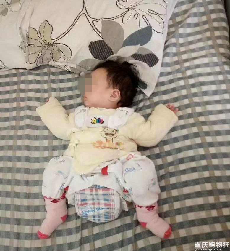 小儿髋关节脱位冶疗历程+【护理日记】
