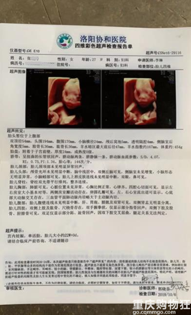 洛阳一女子每次产检都正常，不料却生出畸形儿