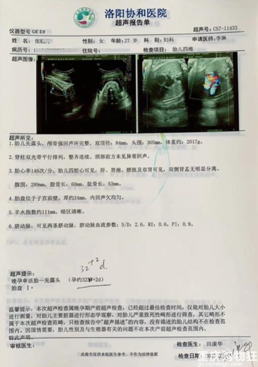 洛阳一女子每次产检都正常，不料却生出畸形儿