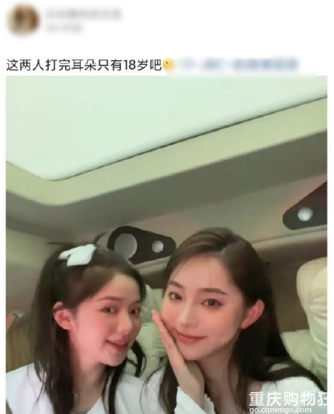 wanghong整容做成精灵耳，有人说是一种病态审美，正常耳朵整成精灵耳