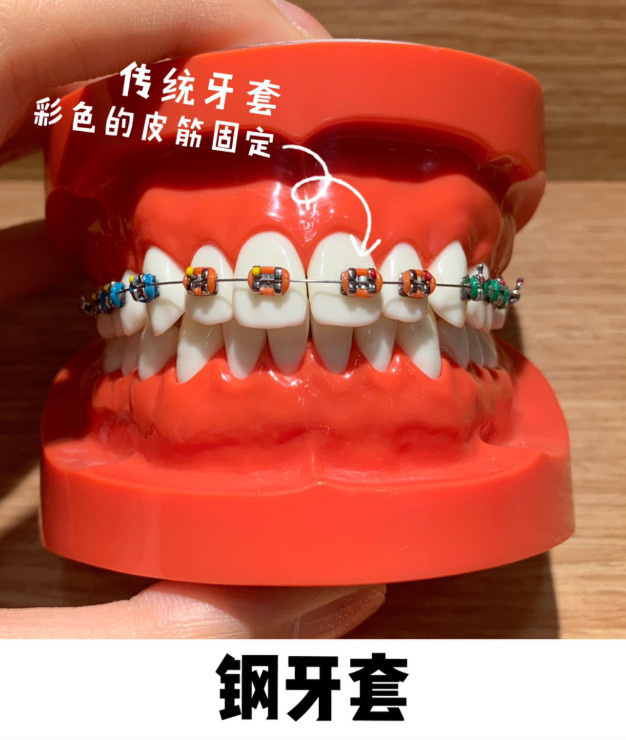 ɶݽɶǻӦѡ