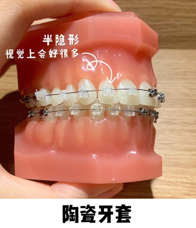 ɶݽɶǻӦѡ