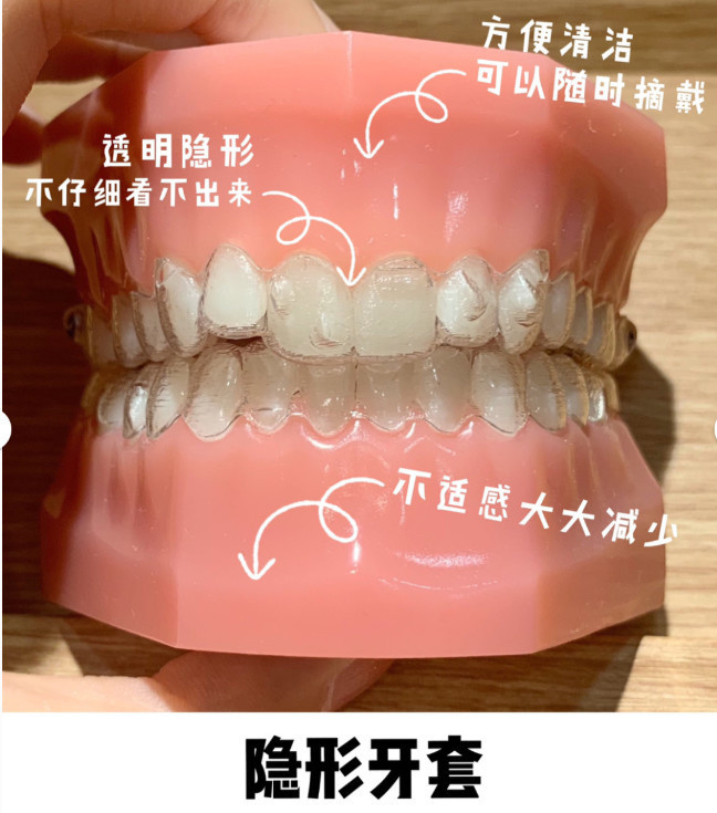 ɶݽɶǻӦѡ