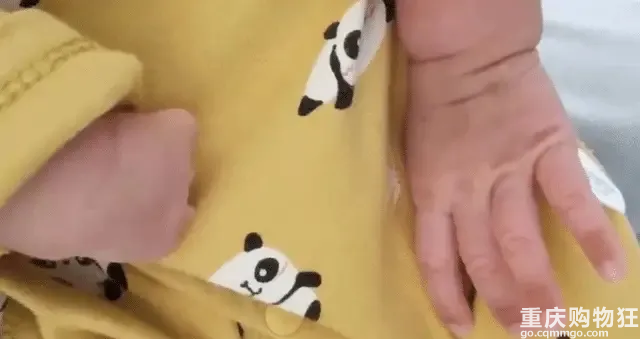 怀孕期间都是全套孕检，孩子出生以后没有右手，谁之过？