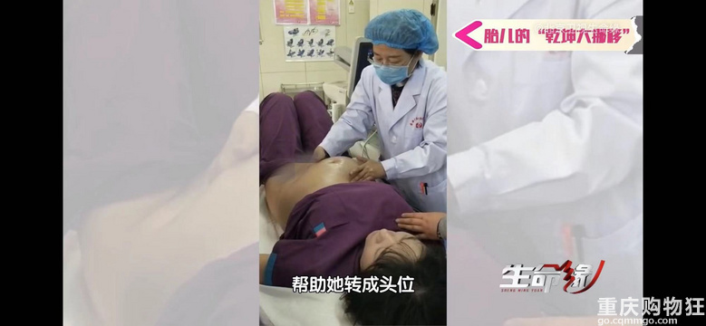 产科主任隔着孕妈肚皮将胎儿倒转180度，纠正胎位！