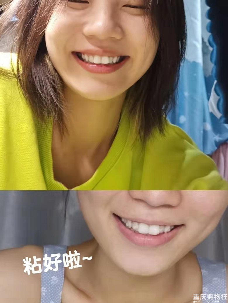关于我的隐形牙套，价格虽贵但真的很好用！