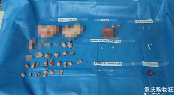愿疼痛不再，愿余生安好！