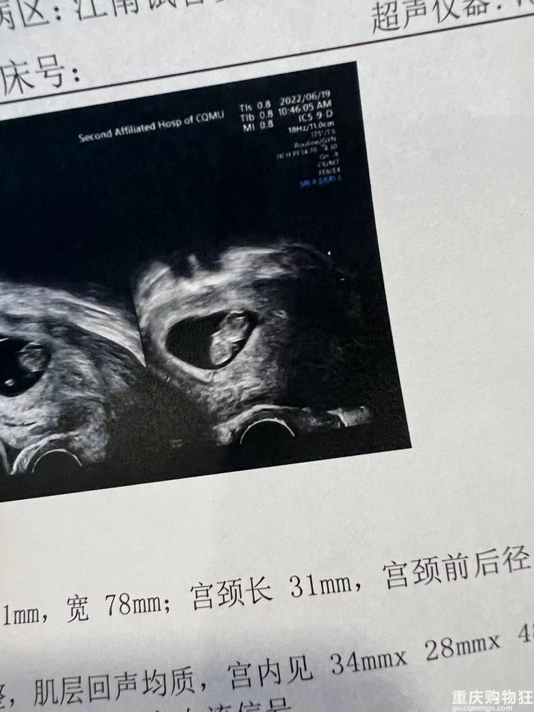 备孕10年，试管2促3移，终于在重医附二院成功上岸了……