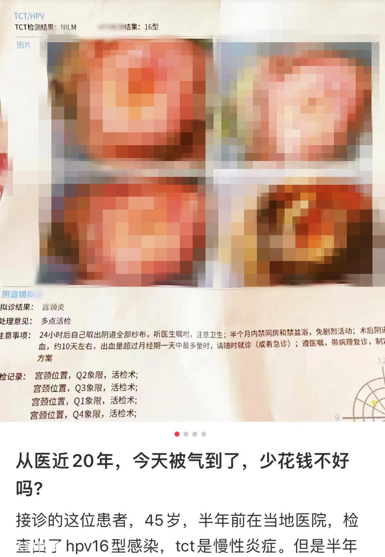 定期的妇科检查真的很重要！！！做了一次两癌检查花费才38元