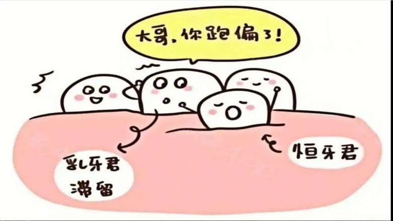 孩子乳牙还没掉，新牙已经长出来怎么办？