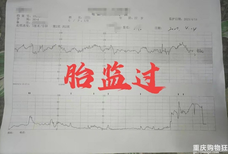 孕36周多，来医院做第8次产检，老公惊呼已花了那么多钱