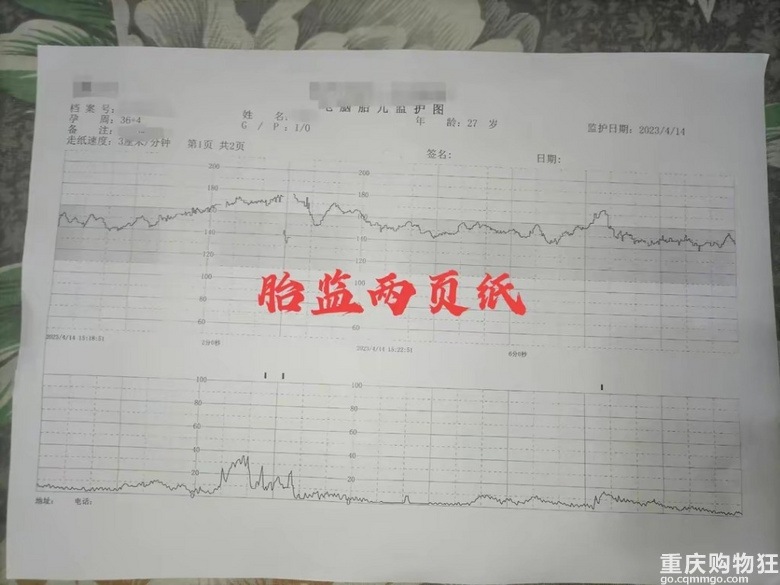孕36周多，来医院做第8次产检，老公惊呼已花了那么多钱