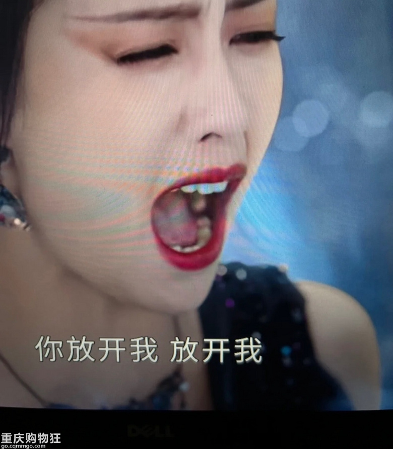 明星也有缺失牙？