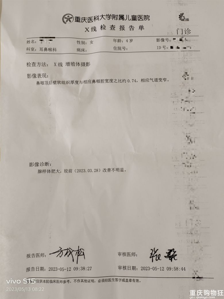 腺样体肥大快80%，直接暴瘦5斤，拖了大半年真后悔手术做晚了！