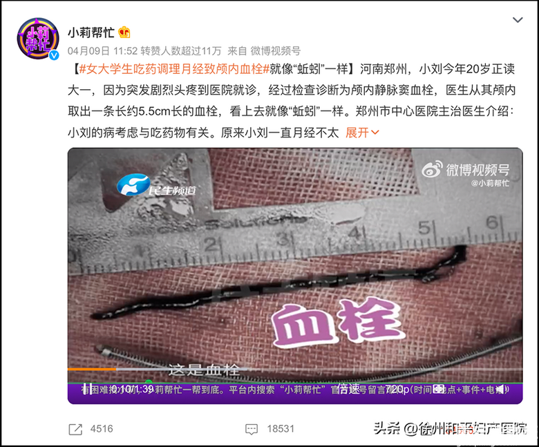 35岁以后，不建议乱用这种避孕方式，副作用大，还伤子宫