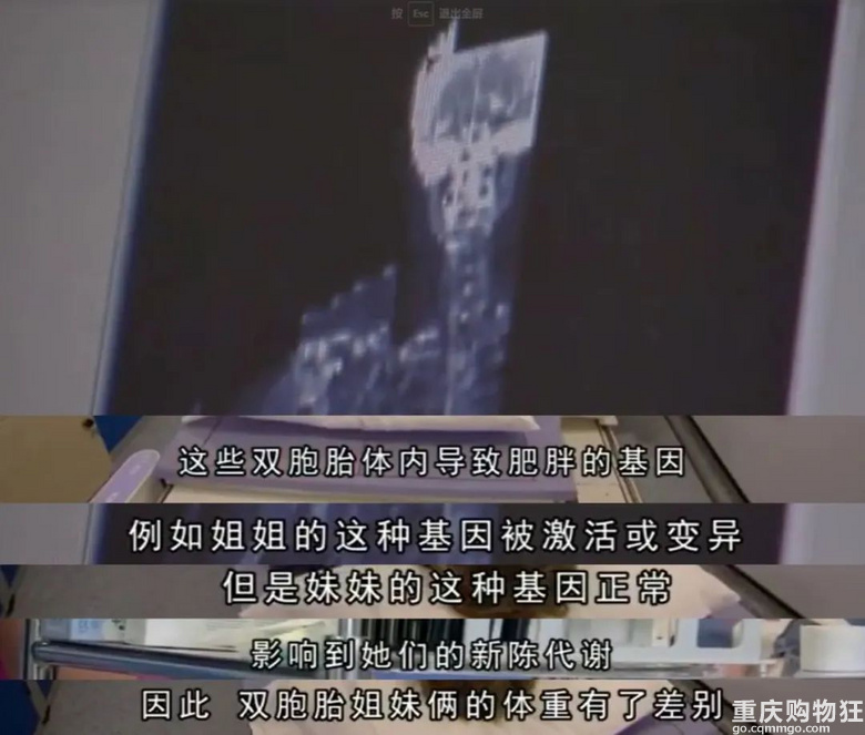 健身真的抗老？双胞胎视觉年龄居然差出20岁…！