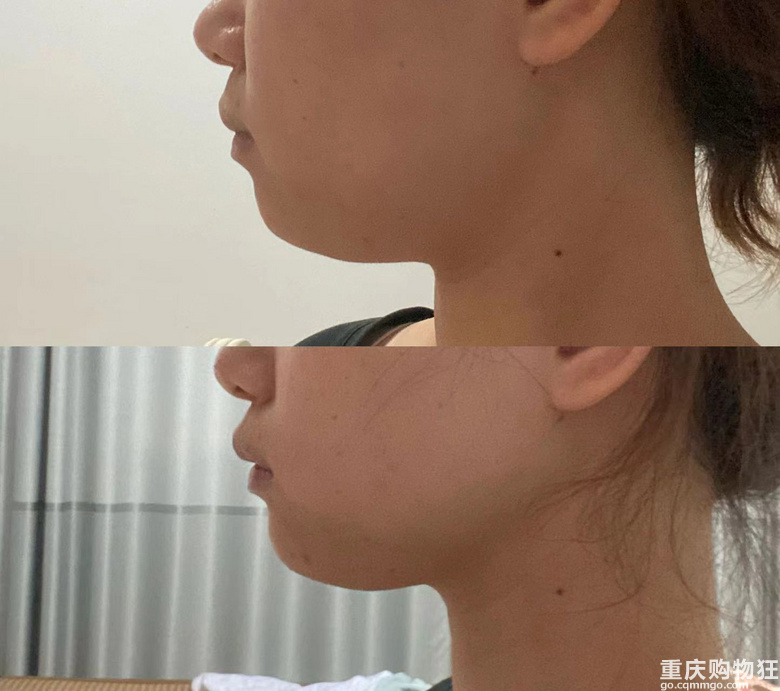 坚持每天打卡瘦脸操半个月对比，下颚线居然清晰了很多！