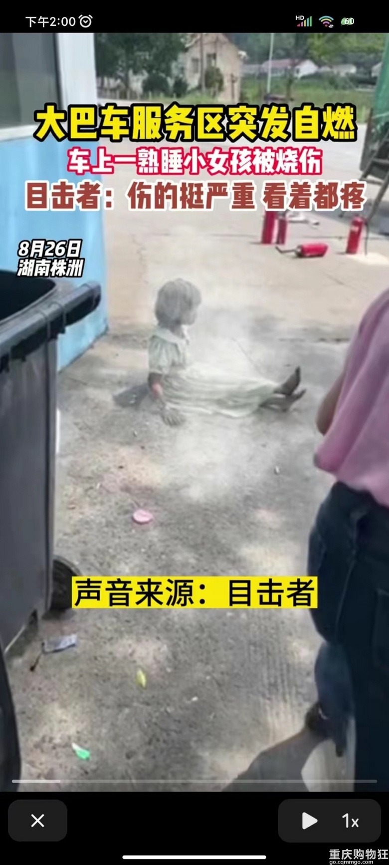 突发！小女孩在车上熟睡被烧伤严重已送医，令人心疼