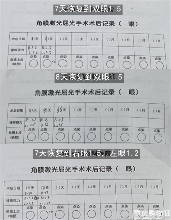 做近视手术，一定要选对医院和医生！他们的视力都恢复到了1.5