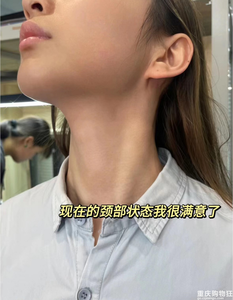 脖子终于干干净净了！没了颈纹，感觉自己都年轻了很多
