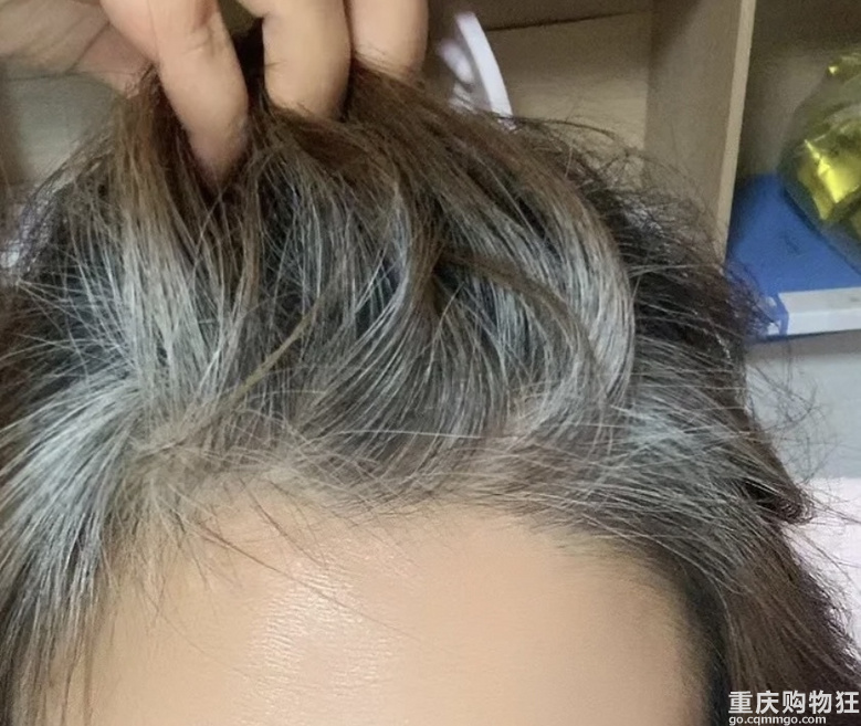 还不到40岁，就好多白发！你怎么处理白发问题的?