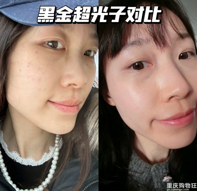 黑金超光子，10天让你换脸