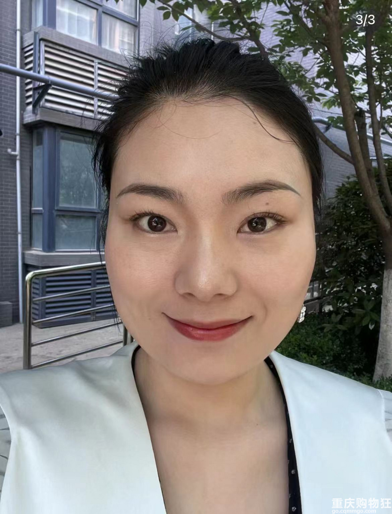 感谢保妥适，拯救了我的抬头纹