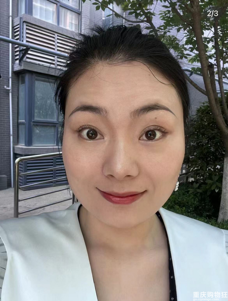 感谢保妥适，拯救了我的抬头纹