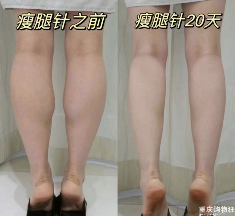 终于拥有了小细腿