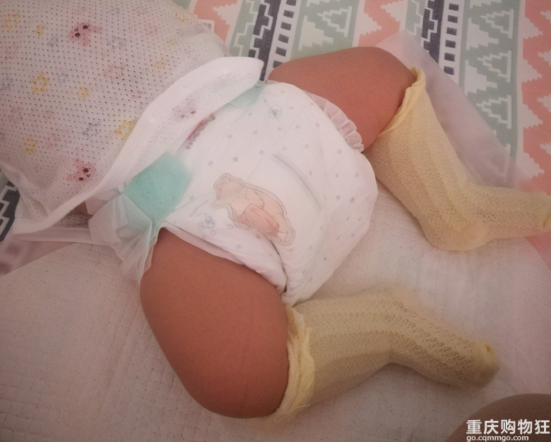 宝宝红屁屁，妈妈在纸尿裤上开“天窗”透气！记牢5要点做好预防