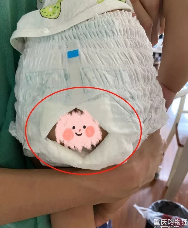 宝宝红屁屁，妈妈在纸尿裤上开“天窗”透气！记牢5要点做好预防