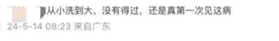 浙江姑娘高烧40℃，肺部长满霉菌！只因清理了发霉衣柜