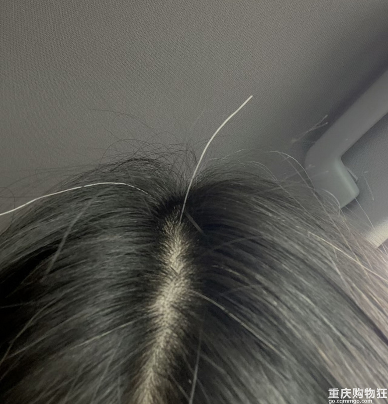 90后的朋友们，你们都开始长白头发了吗？
