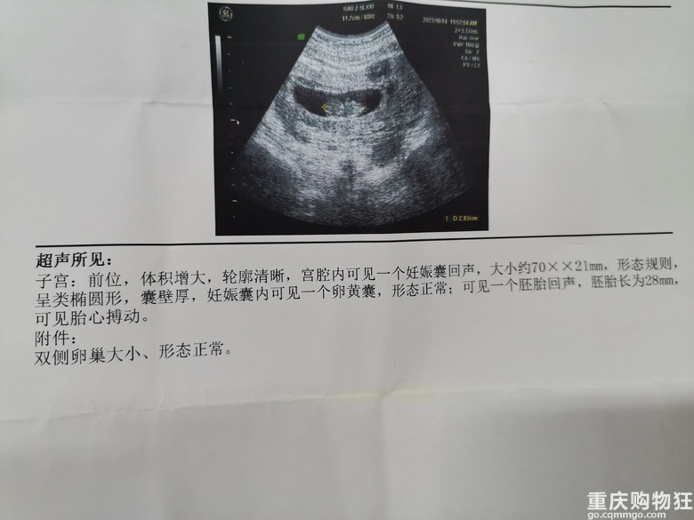 早孕的姐妹有吗？