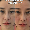 肉脸体验热拉提，离谱的效果