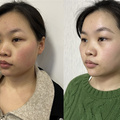 能让问题肌肤一步实现修复+抗衰的黑曜双波微针X，体验感超好！_图0